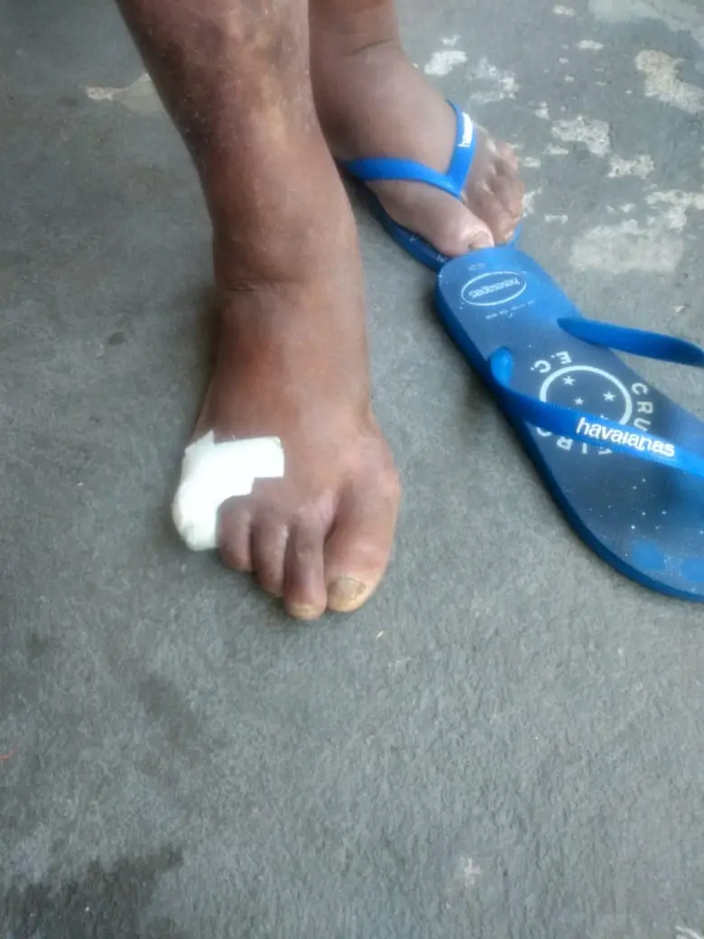 Antes Palmilha